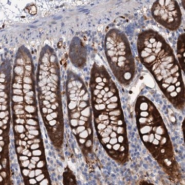 Anti-IL17RD antibody produced in rabbit Prestige Antibodies&#174; Powered by Atlas Antibodies, affinity isolated antibody, buffered aqueous glycerol solution