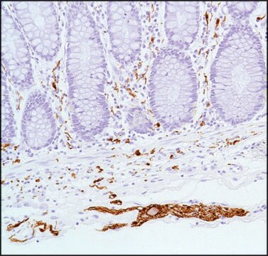 Anti-S100 Beta antibody, Rabbit monoclonal recombinant, expressed in proprietary host, clone SP127, affinity isolated antibody