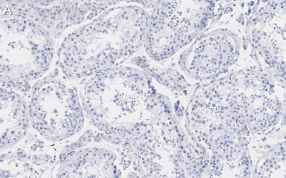 Anti-Pericentrin Antibody, clone 2H11, ZooMAb&#174; Rabbit Monoclonal recombinant, expressed in HEK 293 cells