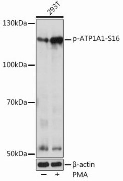 Anti-Phospho-ATP1A1-S16 antibody produced in rabbit