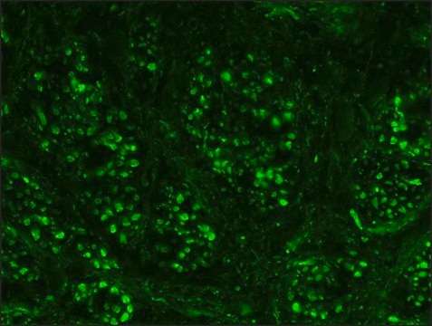 Anti-Neurofilament 200 antibody, Mouse monoclonal clone NE14, purified from hybridoma cell culture