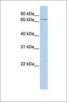 Anti-ALOX15B (ab1) antibody produced in rabbit affinity isolated antibody