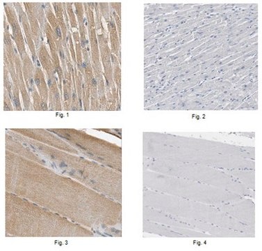 Anti-Lipin-1 Antibody from rabbit, purified by affinity chromatography