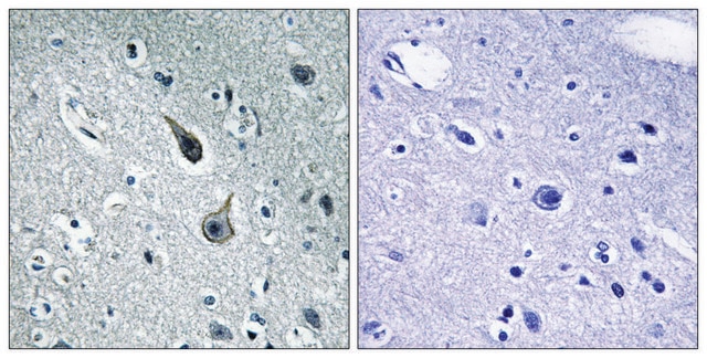 Anti-5-HT-2A antibody produced in rabbit affinity isolated antibody