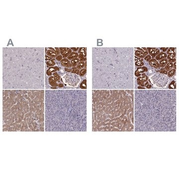 Anti-PAH antibody produced in rabbit Prestige Antibodies&#174; Powered by Atlas Antibodies, affinity isolated antibody, buffered aqueous glycerol solution