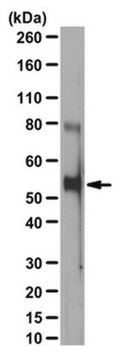 Anti-phospho Beclin Antibody (Thr119) from rabbit, purified by affinity chromatography