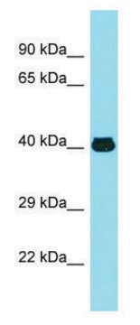 Anti-MFSD2A (N-terminal) antibody produced in rabbit affinity isolated antibody