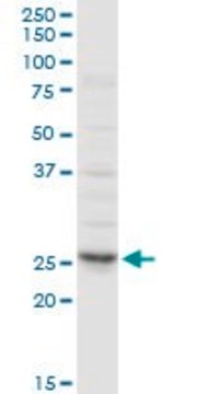 Anti-CLTA antibody produced in rabbit purified immunoglobulin, buffered aqueous solution