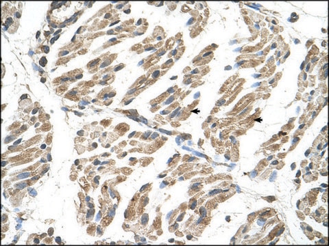 Anti-SLC6A8 antibody produced in rabbit IgG fraction of antiserum