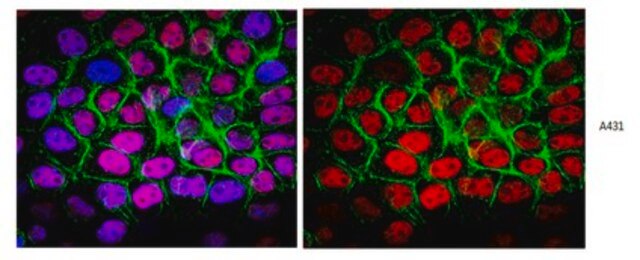 Anti-p53 (pantropic) Antibody, clone DO-1 clone DO-1, from mouse