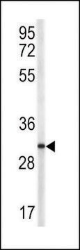 ANTI-TRAP(N-TERMINAL) antibody produced in rabbit purified immunoglobulin, buffered aqueous solution