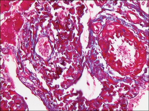 Trichrome TISSUE-TROL&#8482; Control Slides from human liver