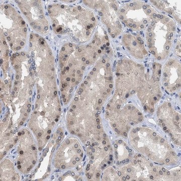 Anti-NUP93 antibody produced in rabbit Prestige Antibodies&#174; Powered by Atlas Antibodies, affinity isolated antibody, buffered aqueous glycerol solution