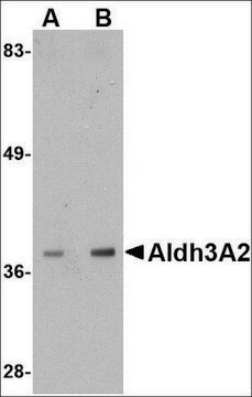 Anti-Aldh3A2 antibody produced in rabbit affinity isolated antibody, buffered aqueous solution