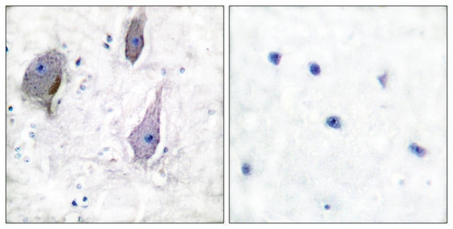 Anti-PMP22 antibody produced in rabbit affinity isolated antibody