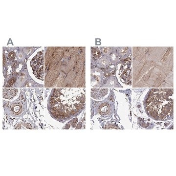 Anti-MAP4 antibody produced in rabbit Prestige Antibodies&#174; Powered by Atlas Antibodies, affinity isolated antibody, buffered aqueous glycerol solution