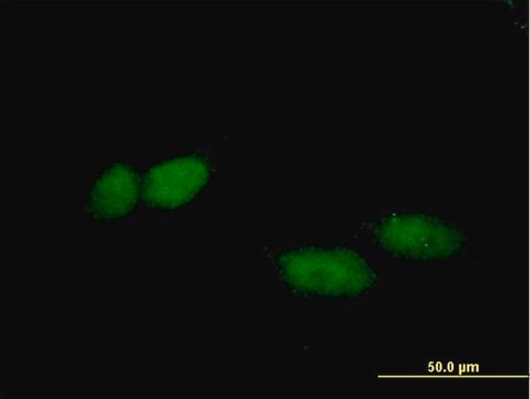 Anti-TBL1X antibody produced in mouse purified immunoglobulin, buffered aqueous solution