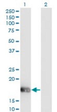 Monoclonal Anti-OMP antibody produced in mouse clone 2B7, purified immunoglobulin, buffered aqueous solution