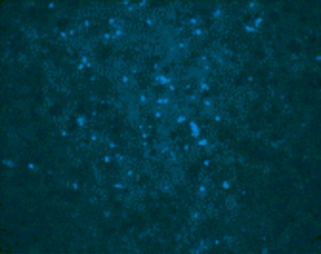 Anti-West Nile Virus Core antibody produced in rabbit affinity isolated antibody