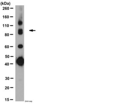 Anti-GABA B Receptor R1 Antibody serum, from guinea pig