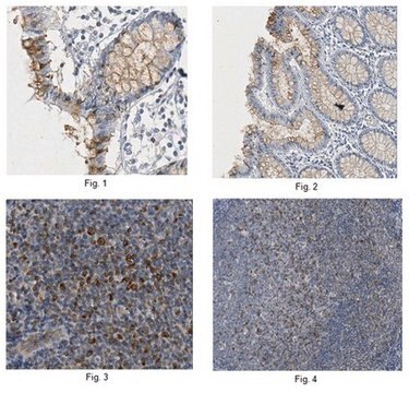 Anti-Claudin-4 Antibody, clone 10B4.3 clone 10B4.3, from mouse