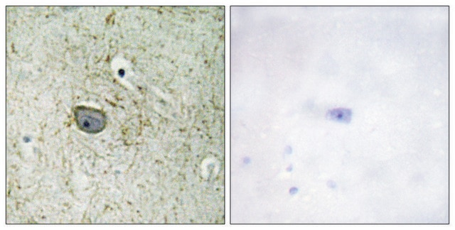 Anti-PDGFR &#945; antibody produced in rabbit affinity isolated antibody