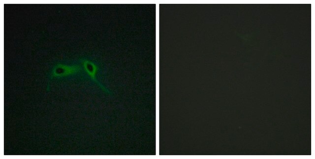 Anti-NF1 antibody produced in rabbit affinity isolated antibody