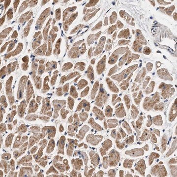 Anti-DCBLD2 antibody produced in rabbit Prestige Antibodies&#174; Powered by Atlas Antibodies, affinity isolated antibody, buffered aqueous glycerol solution