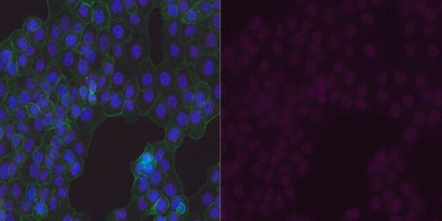 Anti-GLUT-1 Antibody, CT, Alexa Fluor&#8482; 647 Conjugate from rabbit, ALEXA FLUOR&#8482; 647