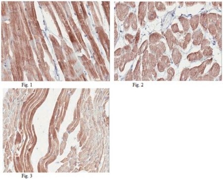 Anti-Titin (NT/Z-domain) Antibody, clone 17D11.1 clone 17D11.1, from mouse