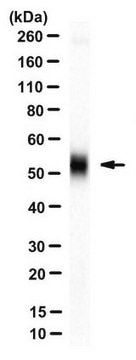 Anti-TXNIP Antibody, clone JY2 clone JY2, from mouse