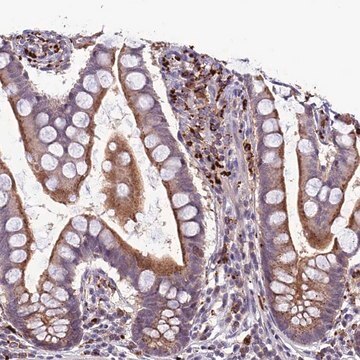 Anti-ARHGEF18 antibody produced in rabbit Prestige Antibodies&#174; Powered by Atlas Antibodies, affinity isolated antibody, buffered aqueous glycerol solution