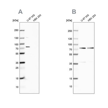 Anti-OPTN antibody produced in rabbit Ab1, Prestige Antibodies&#174; Powered by Atlas Antibodies, affinity isolated antibody, buffered aqueous glycerol solution