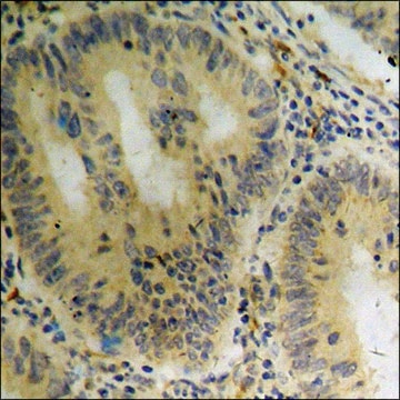 Anti-phospho-ASK1 (pSer966) antibody produced in rabbit affinity isolated antibody