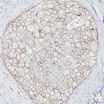 Anti- &#946;-Catenin antibody produced in mouse