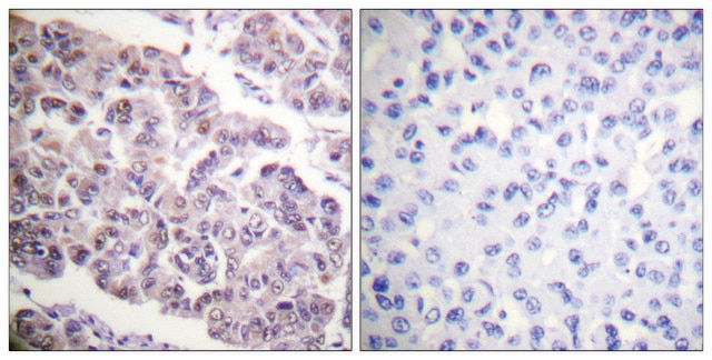 Anti-Histone H4 (Acetyl-Lys12) antibody produced in rabbit affinity isolated antibody