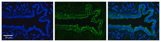 Anti-SerPINE1 (AB1) antibody produced in rabbit affinity isolated antibody