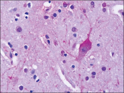 Anti-GRM4 / MGLUR4 antibody produced in rabbit affinity isolated antibody