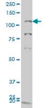 ANTI-GUCY2C antibody produced in mouse clone 1E1, purified immunoglobulin, buffered aqueous solution