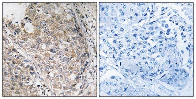 Anti-MKP-1 antibody produced in rabbit affinity isolated antibody