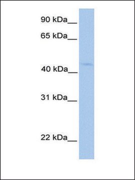 Anti-LIPT1 antibody produced in rabbit affinity isolated antibody