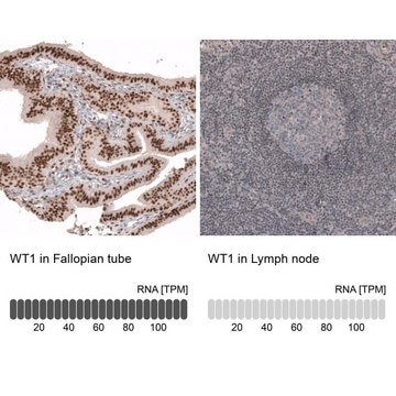 Anti-WT1 antibody produced in mouse Prestige Antibodies&#174; Powered by Atlas Antibodies, clone CL13165, purified by using Protein A, buffered aqueous glycerol solution