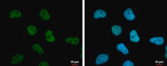 Monoclonal Anti-STAG1 antibody produced in mouse clone GT8810, affinity isolated antibody