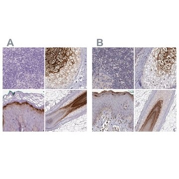 Anti-GSDMA antibody produced in rabbit Prestige Antibodies&#174; Powered by Atlas Antibodies, affinity isolated antibody, buffered aqueous glycerol solution, Ab1