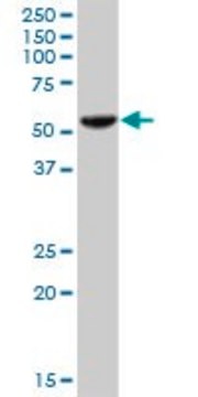 Anti-PHGDH antibody produced in mouse purified immunoglobulin, buffered aqueous solution