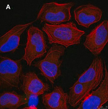 Anti-p-Ubiquitin (pSer65) Antibody, clone 2N21 ZooMAb&#174; Rabbit Monoclonal recombinant, expressed in HEK 293 cells