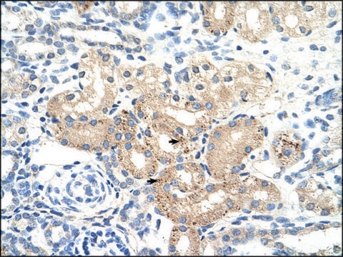 Anti-DLAT antibody produced in rabbit IgG fraction of antiserum