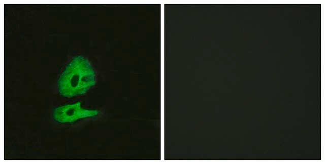 Anti-GLR antibody produced in rabbit affinity isolated antibody