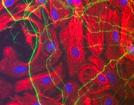 Anti-Neurofilament H Antibody Chemicon&#174;, from chicken