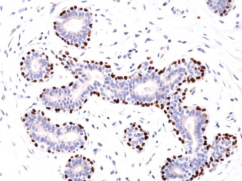 Anti-p63 (Tumor Protein 63) Rabbit Monoclonal Antibody clone RM383, affinity purified immunoglobulin